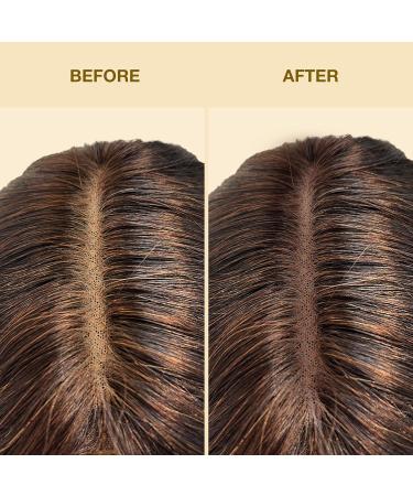 EBIN NEW YORK TInted Lace Spray - Darkest Brown 2.7oz/ 80ml Quick dry Water Resistant No Residue High pigmentation Even Spray Matching Skin Tone Natural Look Tinted Spray for Wig 2.7 Fl Oz (Pack of 1) Darkest Brown - Buy Online on GoSupps.com