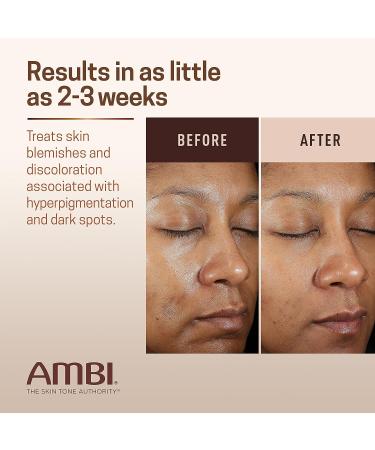 Ambi Even & Clear Fade Cream - Hyperpigmentation Treatment, Dark Spot Corrector with Niacinamide & Licorice Root Extract - 1 Fl Oz - Buy Online on GoSupps.com