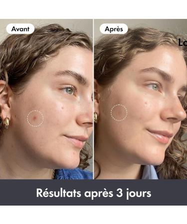 Hero Cosmetics - Rescue Balm Original - Baume Hydratant R parateur Post-Imperfections - Am liore l apparence des marques laiss es par les boutons - 15 mL RG Original baume - Buy Online on GoSupps.com