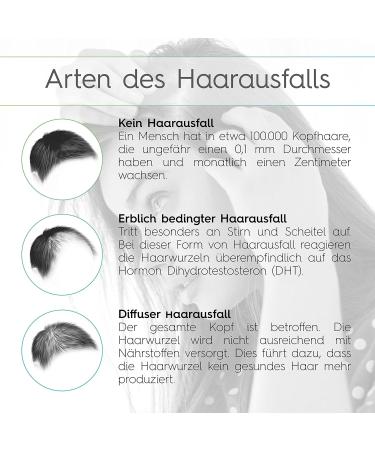 Vitabay Hair Growth Solution 70ml | Effective Serum for Hair Loss | Hair Thickening & Growth for Men & Women - Buy Online on GoSupps.com