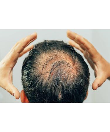 Buy Kami Hair Growth Scalp Therapy - Sterile Microneedling Serum for Dermapen & Dermaroller | Stop Hair Loss & Stimulate Growth - 10 Active Ingredient Ampoules (10 ml) - Buy Online on GoSupps.com