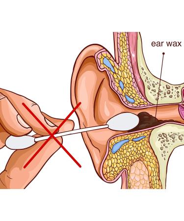REMOS Stainless Steel Ear Loop & Spoon - Effective Ear Wax Removal Tool (White) | International Shipping Available - Buy Online on GoSupps.com
