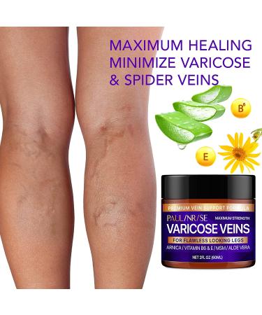Natural Varicose Veins Cream for Pain Relief - Effective Treatment for Varicose and Spider Veins on Legs - Buy Online on GoSupps.com
