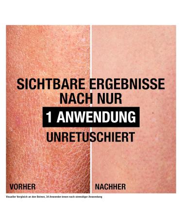 Neutrogena Norwegian Formula Skin-Repairing Bodymilk (250ml) - Glycerin & Collagen-Boosting Moisturizer for All Skin Types - Buy Internationally - Buy Online on GoSupps.com