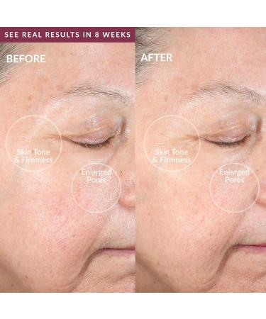 PMD Clean Pro RQ - Smart Face Cleaning Device | Silicone Brush & Rose Quartz | Anti-Aging Massage | Waterproof SonicGlow Clear Pores & Blackheads - Buy Online on GoSupps.com