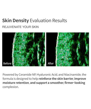 Foretderm EGF Revital Lift Cream Anti Aging Moisturizer With Liposome EGF Niacinamide Hyaluronic Acid Ceramide Panthenol Hydrating Barrier Repair Korean Face Cream for Sensitive Skin 1.7 Fl Oz - Buy Online on GoSupps.com