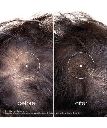 Klorane - Strengthening Serum with Quinine and Organic Edelweiss - Supports Stronger Hair For Men and Women - 100ml - Buy Online on GoSupps.com