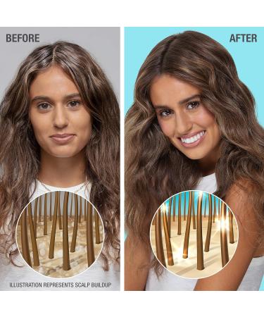 Neutrogena Moisturizing Healthy Scalp Hydro Boost Conditioner for Dry Hair and Scalp with Hydrating Hyaluronic Acid pH-Balanced Paraben & Phthalate-Free Color-Safe 354 ml Conditioner Blue - Buy Online on GoSupps.com