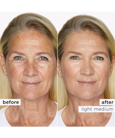 Sugar Rush Skin Treat Concealer - Light-Medium - 4g Full Size - Buy Online on GoSupps.com