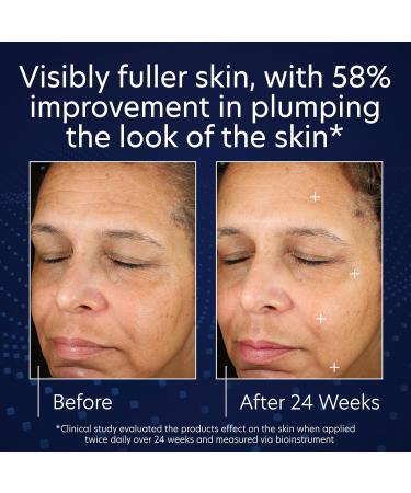 PCA SKIN Pro Max Age Renewal Anti Aging Serum - Reduces Wrinkles & Sagging Skin Lifts & Firms Face & Neck Safe for All Skin Types 1.0 oz - Buy Online on GoSupps.com