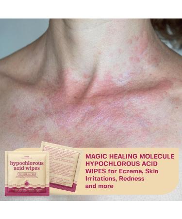 BASE LABORATORIES Hypochlorous Acid Wipes - Saline Solution Skin & Face Cleansing Wipes | Soothes Irritations Acne & Eczema | 75 Wipes Pack - Buy Online on GoSupps.com