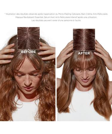 K rastase Symbiose Soin Micro-Exfoliant & Purifiant Anti-Pelliculaire Pour Cuirs Chevelus Sensibles Tendance Pelliculaire Sans Sulfate Micro-Peeling Cellulaire 200 ml - Buy Online on GoSupps.com