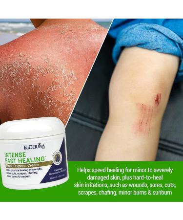 TriDerma Intense Fast Healing Cream - 4 Ounces | Accelerates Healing for Minor Skin Irritations, Rashes, Scrapes, Cuts - Buy Online on GoSupps.com