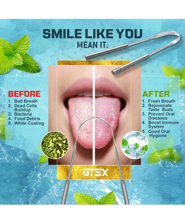 Medical Grade Stainless Steel Tongue Scraper - Set of 2 for Adults - Tounge Cleaner for Fresh Breath and Oral Health - Buy Online on GoSupps.com