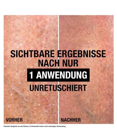 Neutrogena Norwegian Formula Intense Repair Cica Body Balm 250ml - Deep Moisturizing & Non-Fatty Formula with Glycerin & Centella Asiatica for Very Dry Skin - Buy Online on GoSupps.com