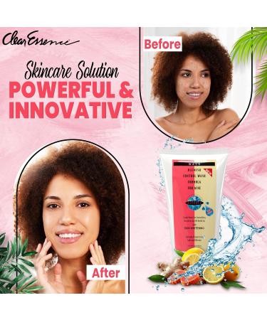 Clear Essence Platinum Blemish Control Wash - Acne Face Wash for Oily Skin & Body - 5.0 Oz - Dermatologist Tested - Buy Online on GoSupps.com