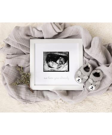 Little Pear Gender-Neutral Sonogram Frame for Pregnancy Announcement and Mother's Day - White Nursery Decor Keepsake - Buy Online on GoSupps.com