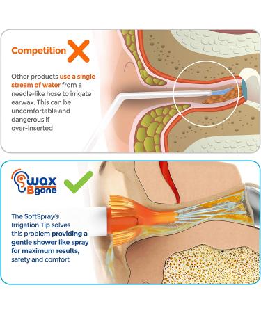 WaxBgone Ear Wax Removal Kit with SoftSpray Irrigation Tips - Safe & Effective Removal for Adults & Kids - Includes Softening Drops & Rigid Wand - Buy Online on GoSupps.com