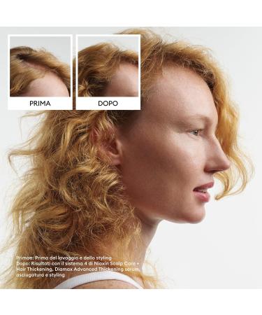 Nioxin 4 Triphasic Kit Shampoo 150ml Conditioner 150ml Treatment 40ml advanced thinning kit - Buy Online on GoSupps.com