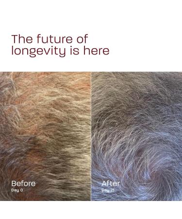 Growth Revive Scalp Serum - Hair Loss Protection | 2x30 ml - International Shipping Available - Buy Online on GoSupps.com