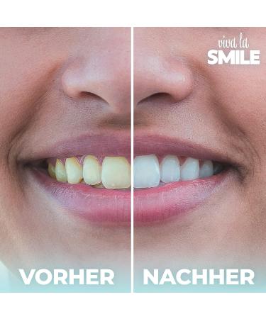 Viva La Smile Coconut Activated Carbon Powder for Teeth Whitening - Natural Charcoal Toothpaste (Mint) - Brighten Your Smile - Buy Online on GoSupps.com
