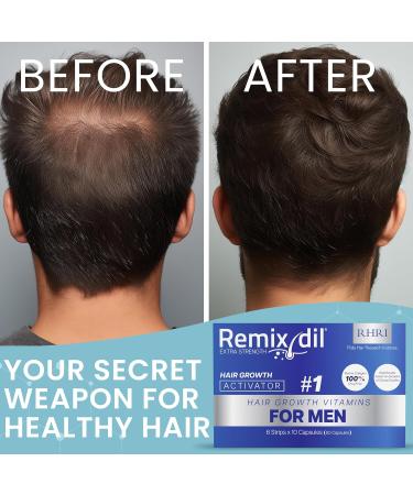 Remixidil Hair Growth Supplements for Men | Clinically Tested Vitamins for Hair & Beard | Fast-Acting Formula to Thicken & Strengthen Hair | 60 Capsules - Buy Online on GoSupps.com
