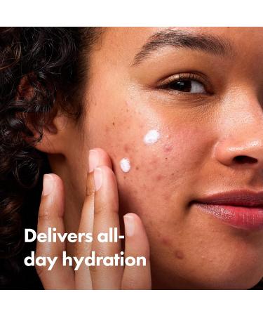 Hero Cosmetics Rescue Balm (New Formula)-The Post-Blemish Cream to Boost Hydration and Improve the Look of Post-Blemish Marks. Derm-Tested. New Formula. Won t Clog Pores. 15mL - Buy Online on GoSupps.com