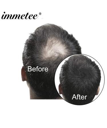 IMMETEE Hair Building Fibers - Instant Regrowth for Thinning Hair & Bald Spots - 28g Black - Conceals Hair Loss in 15 Seconds - For Men & Women - Buy Online on GoSupps.com