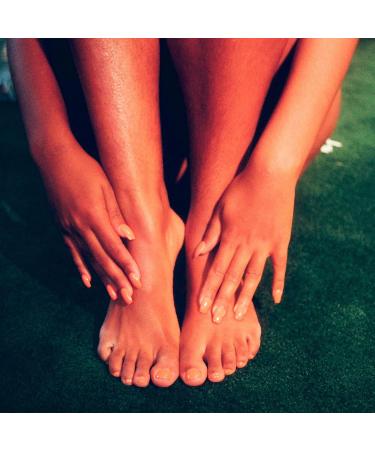 Varicose Veins Balm 120ml - Treatment for Varicose, Spider Veins, Acne, Stretch Marks - Buy Online on GoSupps.com