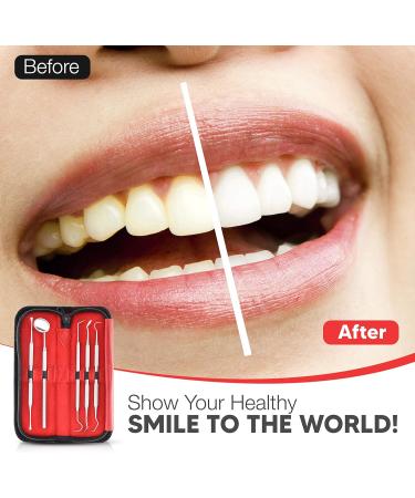 Premium 5-Piece Dental Care Set - Deep Tooth Cleaning Tools - Stainless Steel Dentist Kit for Personal Use - Buy Online on GoSupps.com