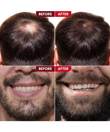 Strong Roots Men Texture Curl Cream - Flexible Hold & Moisturizing Curl Enhancer with Jamaican Black Castor Oil | Anti-Frizz & Easy to Style - Buy Online on GoSupps.com