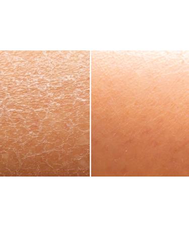 Flawsome 100% Natural Organic Arabica Ground Coffee Cellulite Reducing Body Scrub by Skin and Senses (11.5oz) With Vitamin E Carrot Seed Oil and Coconut Oil - Buy Online on GoSupps.com