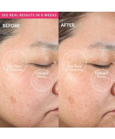 Shop the Best Clean Facial Cleansing Device in Pink - International Shipping Available - Buy Online on GoSupps.com