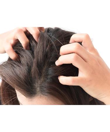 Difeel Scalp Care Tea Tree Oil - 99% Natural Premium Hair Oil | 8 oz | International Shipping Available - Buy Online on GoSupps.com