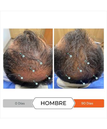 Revita Volumizing Shampoo for Thinning Hair - Supports Hair Growth, Strengthens and Thickens Hair - Sulfate Free, DHT Blocker - 31 Fl Oz - Buy Online on GoSupps.com