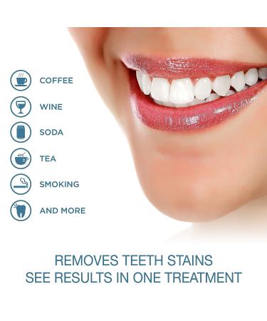 Teeth Whitening Pen (2 pk) - 20+ Treatments Each | Instant Whitening, Painless & No Sensitivity | Whiter in 1 Minute | On the Go & Easy Brush On | 35% Carbamide Peroxide - Buy Online on GoSupps.com