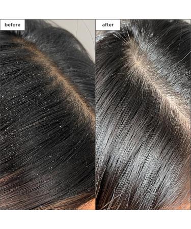 Briogeo Scalp Revival Detox Spray | Vegan Dry Scalp Treatment & Charcoal Cleanser - 4 fl oz - Buy Online on GoSupps.com