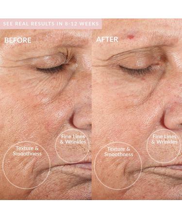 PMD Personal Microderm Classic: At-Home Microdermabrasion Machine for Face & Body - Exfoliating Crystals for Radiant Skin - Buy Online on GoSupps.com