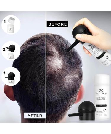 Buy COMPLETE SET 5-in-1 ADONIS Hair Fiber Kit - All Natural Keratin Hair Fibers for Thinning Hair | Fast International Shipping - Buy Online on GoSupps.com