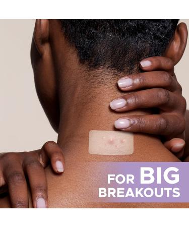 SOS SAVER OF SKIN - Hydrocolloid Acne Patches for Body Back Chest & More | 10 Count | Vegan & Latex Free - Buy Online on GoSupps.com
