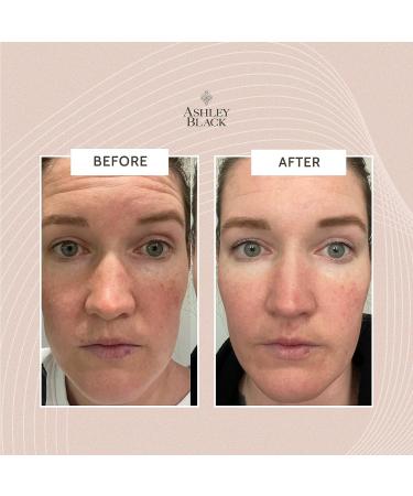OMGBlaster by Ashley Black: 5-in-1 Face Massager for Fine Lines & Wrinkles - Multi-Attachment Facial Tool - Buy Online on GoSupps.com