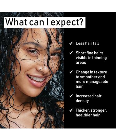 Évolis Prevent Anti-Aging Conditioner | Natural Anti-Hair Loss Treatment for Men & Women | Ideal for Sensitive Scalp & Oily Hair | 8.5 fl oz - Buy Online on GoSupps.com