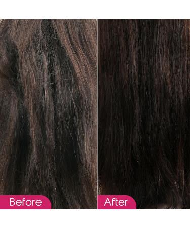 Wonder Wig Solution Detangling Refresher Spray 8.5oz for Wig| Protecting Hair and Gives Hydration with Shea Butter Infused Formula Moisturizing and Soften Hair Detangler Hair with High Shine 8.5 Fl Oz (Pack of 1) Detangling Refresher - Buy Online on GoSupps.com