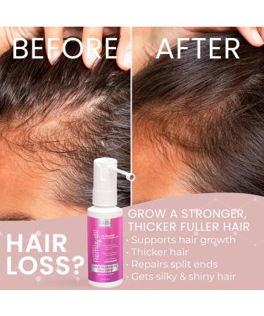Remixidil Minoxidil 2% Hair Growth Spray for Women - Thinning Hair Regrowth & Thickening Treatment | Fast International Shipping - Buy Online on GoSupps.com