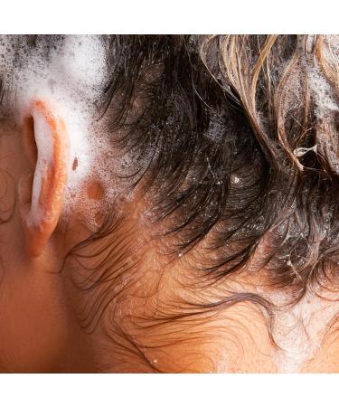 NOT!CE Hair Co. Hydrator Shampoo & Conditioner Bars - Travel Set for Moisturizing Dry & Curly Hair - International Shipping - Buy Online on GoSupps.com