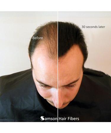 Refill kit Hair Fiber By Samson XLarge 50 Grams Hide Hair Loss and Hair Transplant Natural Looking Results Made in USA Hair Loss Concealer (Light Brown) - Buy Online on GoSupps.com