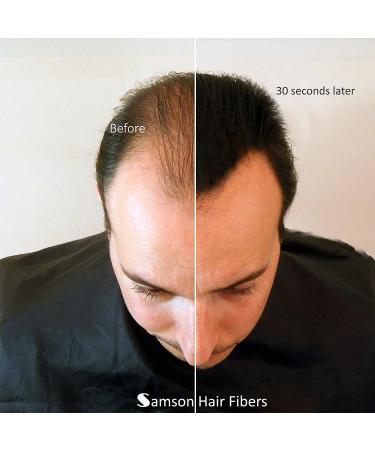 Samson Hair Fibers for Thinning Hair - 100% Natural Formula - Covers Bald Spots & Conceals Hair Loss Instantly - 25g Med. Brown Refill - Buy Online on GoSupps.com