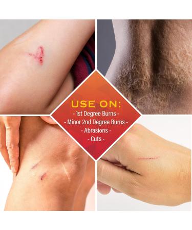 Scar Zone Burn Pain Relief Gel - Extra Strength Topical Analgesic for Minor Cuts, Burns & Abrasions (0.5 oz) - Buy Online on GoSupps.com