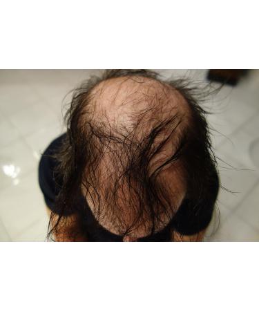 Finally Hair Fiber Refill 100 g for Hair Loss Concealing by Finally Hair (noir) - Buy Online on GoSupps.com