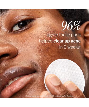 First Aid Beauty Acne Pads for Face - Maximum Strength Acne Treatment - 2% Salicylic Acid Pads Treat Without Drying (60-ct) 60 Count (Pack of 1) Acne - Buy Online on GoSupps.com